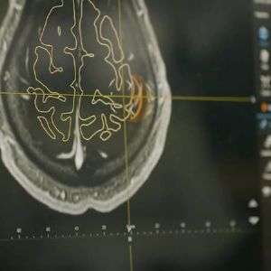 Neuralink : contrôler un bras robotique par la pensée, le futur selon Elon Musk