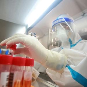 Covid-19 : Origine possible en laboratoire à Wuhan? Une piste sérieusement étudiée par des élus américains