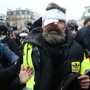 Policier devant la cour criminelle pour avoir éborgné un "gilet jaune"